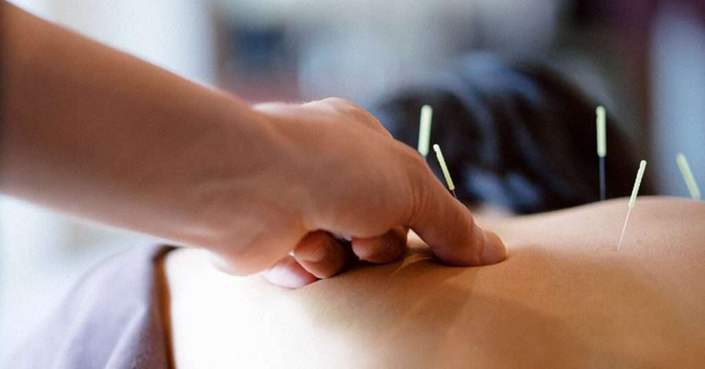 کاشت نخ امبدینگ لاغری در شکم بیمار توسط پزشک