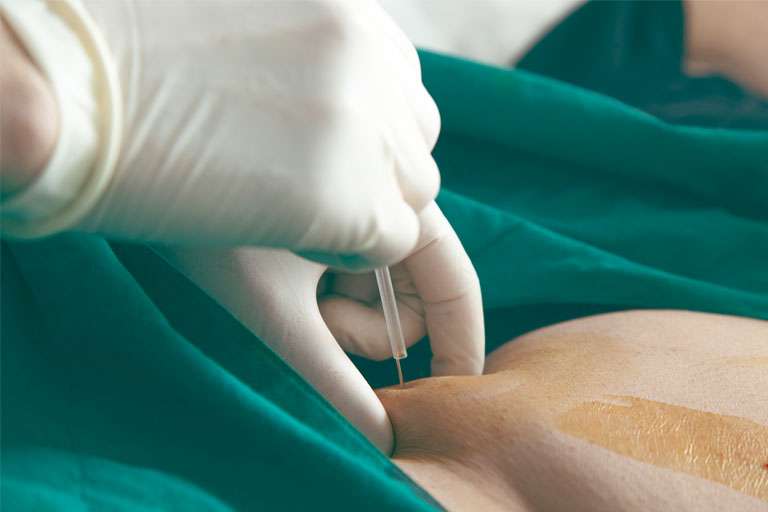 عوارض امبدینگ شکم چیست