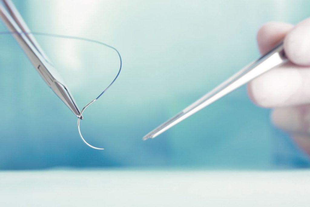 سوزن و نخ امبدینگ لاغری در دستان پزشک