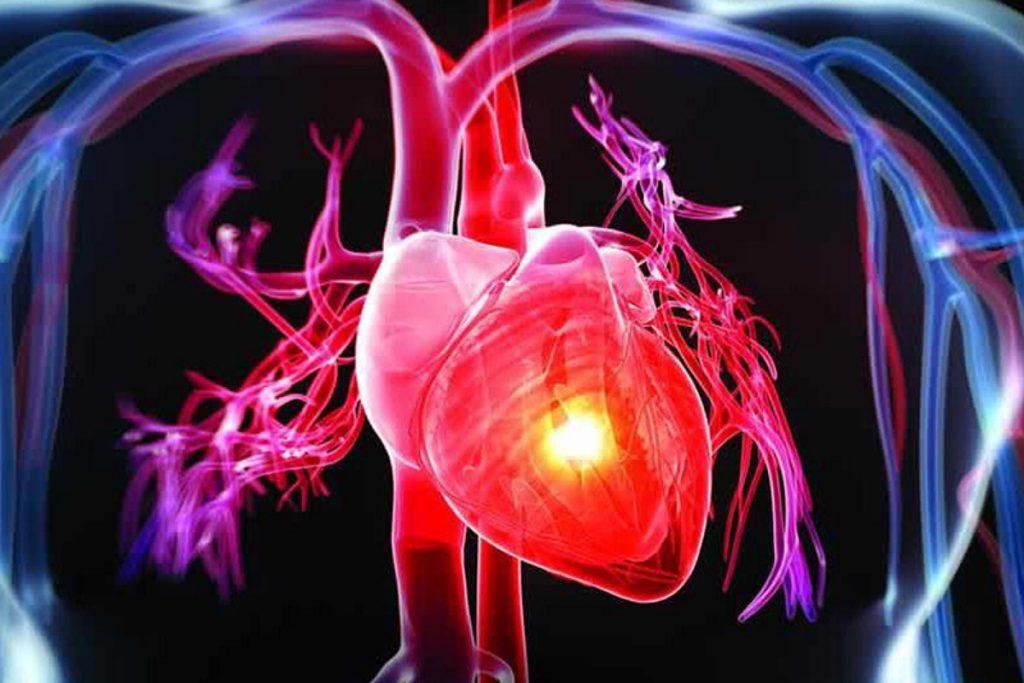 ممنوعیت رژیم سه روزه برای بیماران قلبی رژیم لاغری 3 روزه