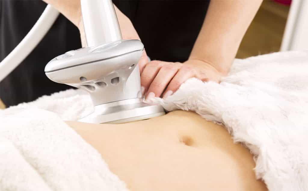 لاغری با دستگاه توسط دکتر نیره اسماعیل کابلی دکتر درحال کار است. لاغری با دستگاه بر روی شکم بیمار انجام می شود