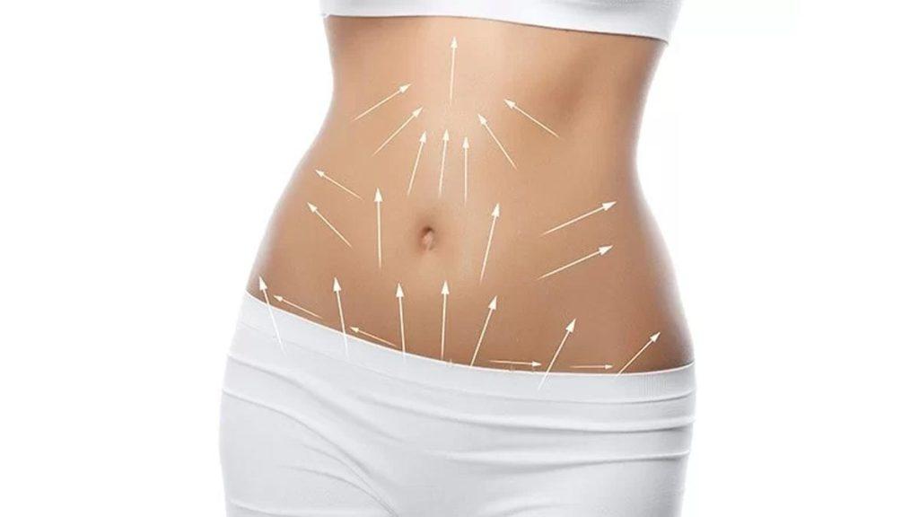 نقاط مهم برای لاغری شکم و پهلو با کاشت نخ بر روی بدن یک خانم نشان داده شده است