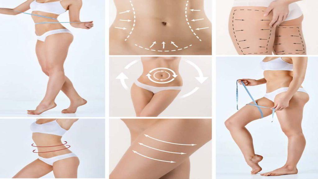 نقاط و خطوط طب سوزنی امبدینگ لاغری که بر روی بدن چند خانم مشخص شده است و به امبدینگ چگونه باعث لاغری میشود اشاره دارد