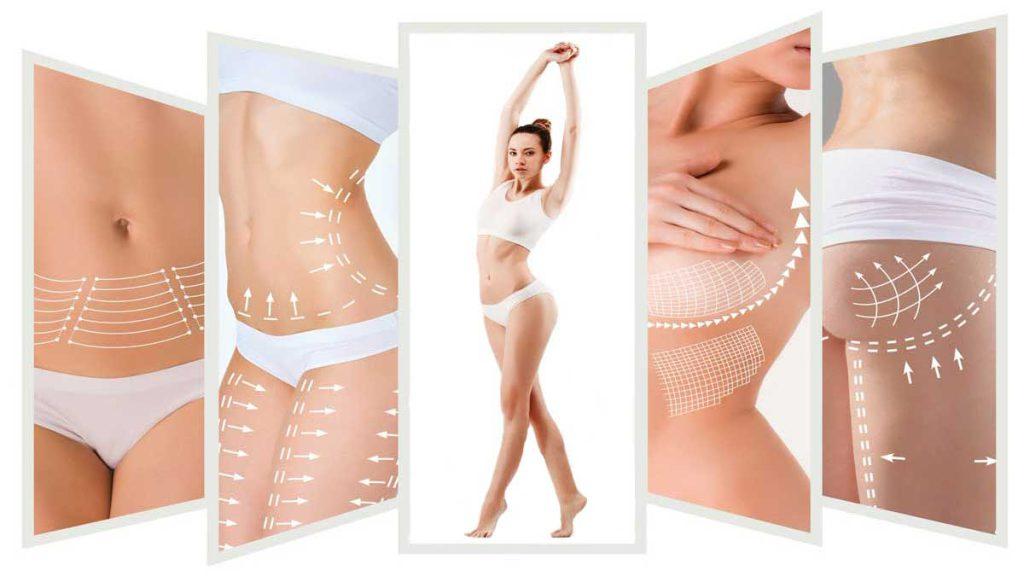 قسمت های مختلف بدن یک خانم برای مزو امبدینگ لاغری علامت گذاری شده است