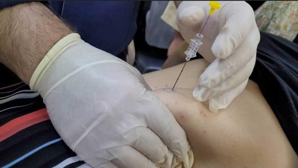 مقایسه مزو امبدینگ لاغری با روش های درمانی دیگر پزشکی که سوزن مزو امبدینگ را به شکم بیمار فرو کرده است و به مقایسه مزو امبدینگ لاغری با سایر روش های درمانی اشاره دارد