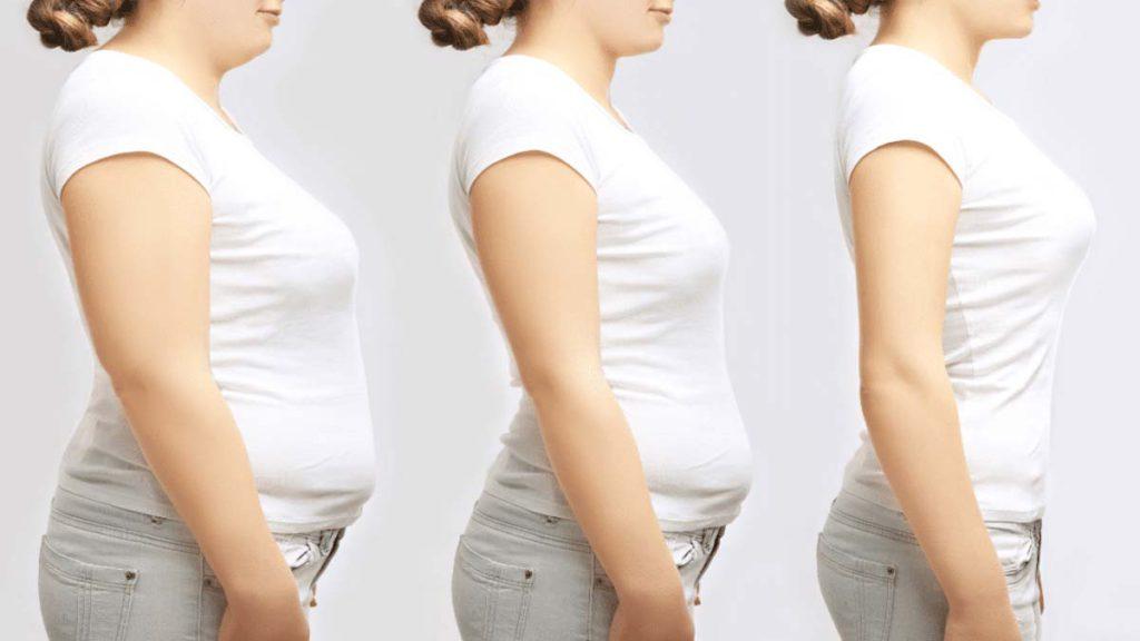 روند کاهش وزن با امبدینگ را در سه خانم نشان می دهد که به نتایج و نظرات در مورد امبدینگ نخ لاغری اشاره دارد