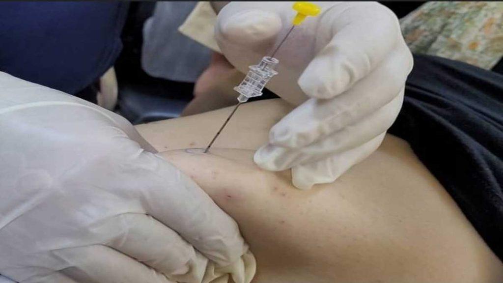 طب سوزنی امبدیگ لاغری و تفاوت امبدینگ در طب سوزنی چیست پزشکی که سوزن طب سوزنی امبدینگ لاغری را به شکم بیمار فرو کرده است و به تفاوت امبدینگ در طب سوزنی چیست اشاره دارد