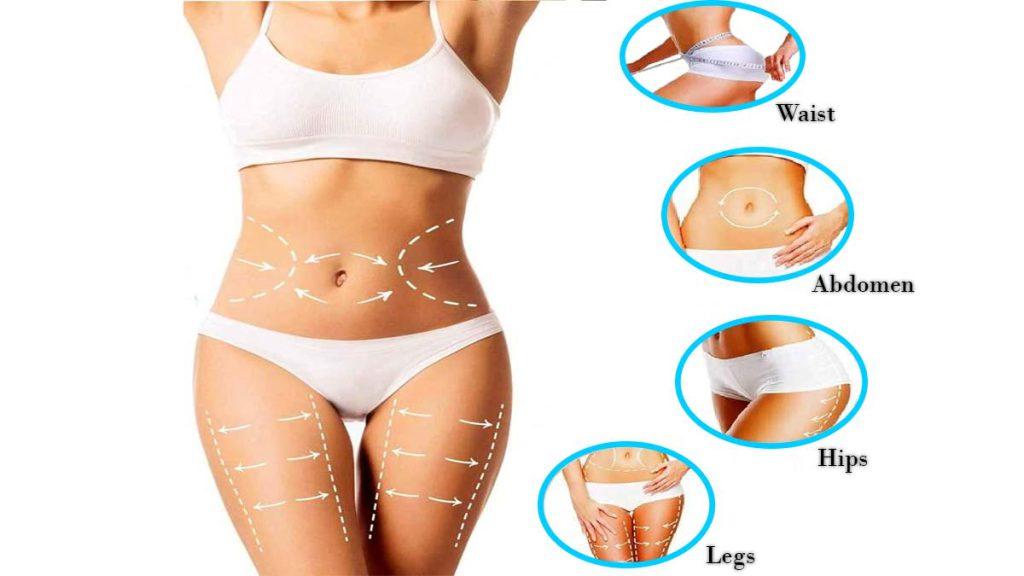 نواحی مختلف بدن یک خانم که با خطوط مشخص شده است و تاثیر امبدینگ برای لاغری شکم نشان می دهد