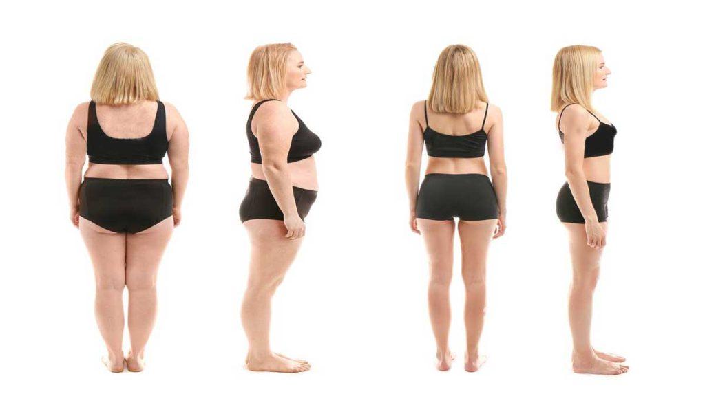 لاغری و کاهش وزن یک خانم با امبدینگ لاغری شکم و پهلو که به با امبدینگ چند کیلو لاغر می‌شویم؟ اشاره دارد