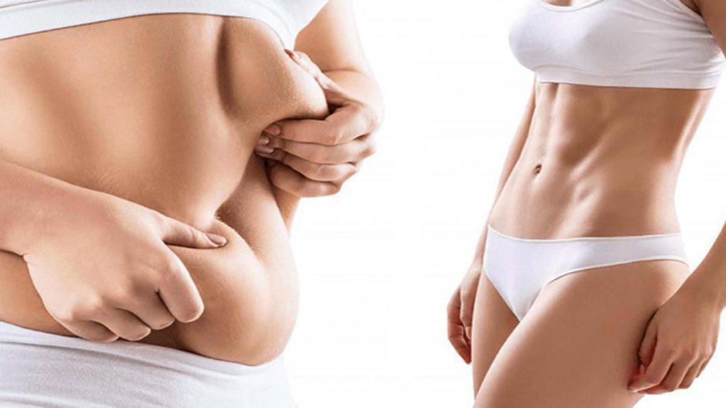 یک خانم لاغر و یک خانم چاق که اضافه وزن خود را در ناحیه شکم نشان می دهد و به فواید کاشت نخ امبدینگ برای لاغری شکم اشاره دارد