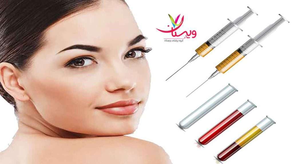 جایگزین پی ار پی جایگزین پی ار پی