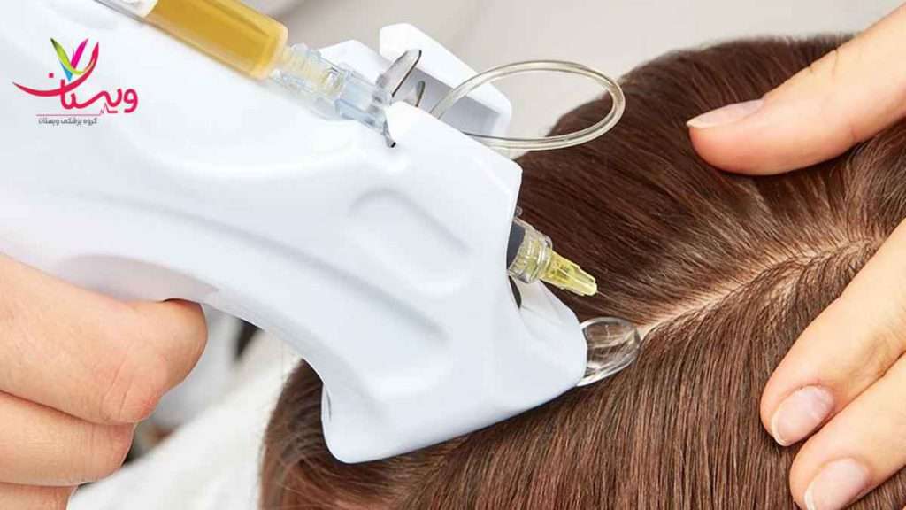 تاثیر پی ار پی زمان تاثیر پی ار پی