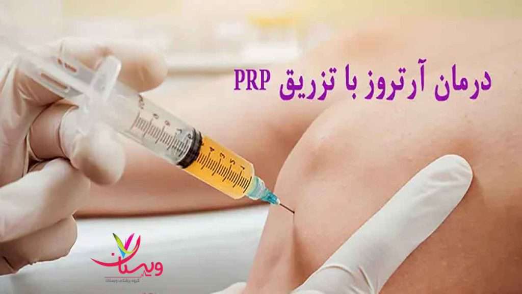 درمان آرتروز روش های درمان آرتروز