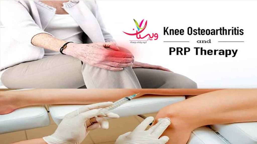جوانسازی زانو جوانسازی زانو