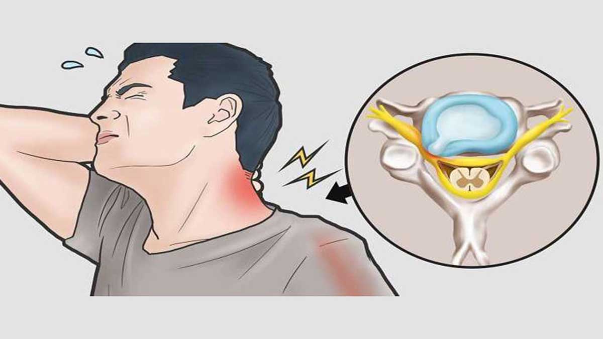 نشانه های بیماری میوپاتی علائم بیماری میوپاتی