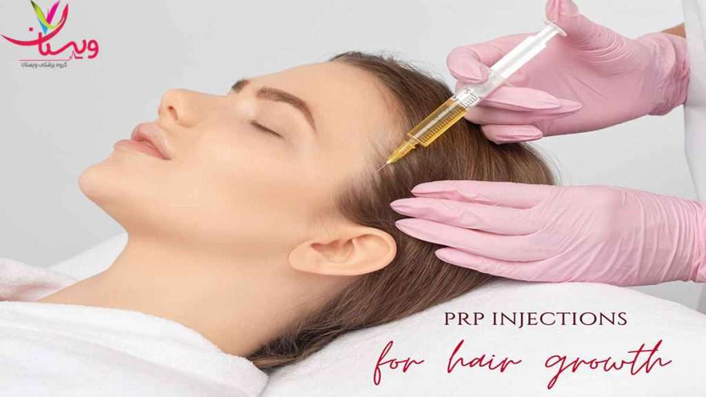 تاثیر پی ار پی میزان تاثیر پی ار پی