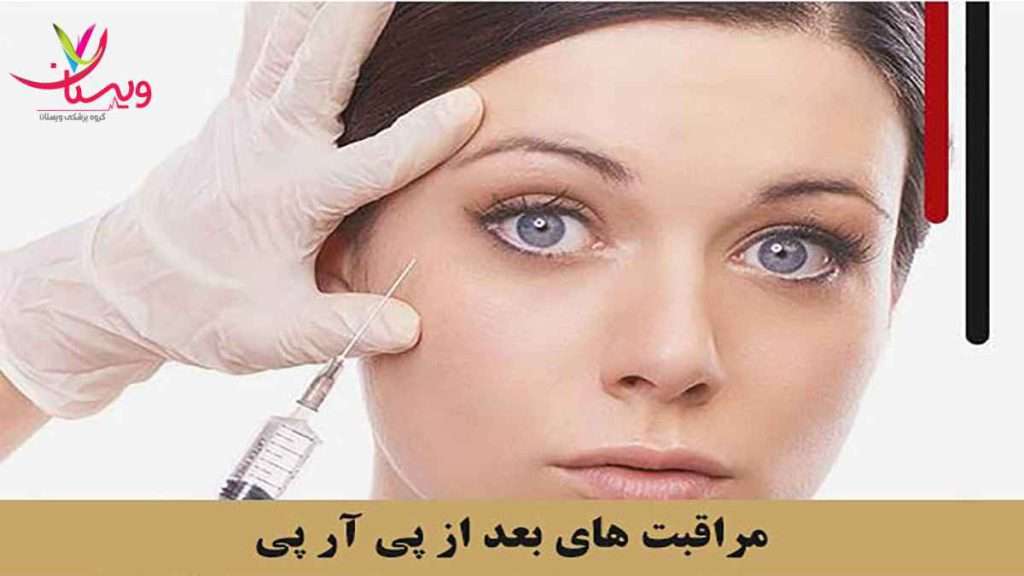 مراقبت های پی ار پی صورت مراقبت بعد از پی ار پی