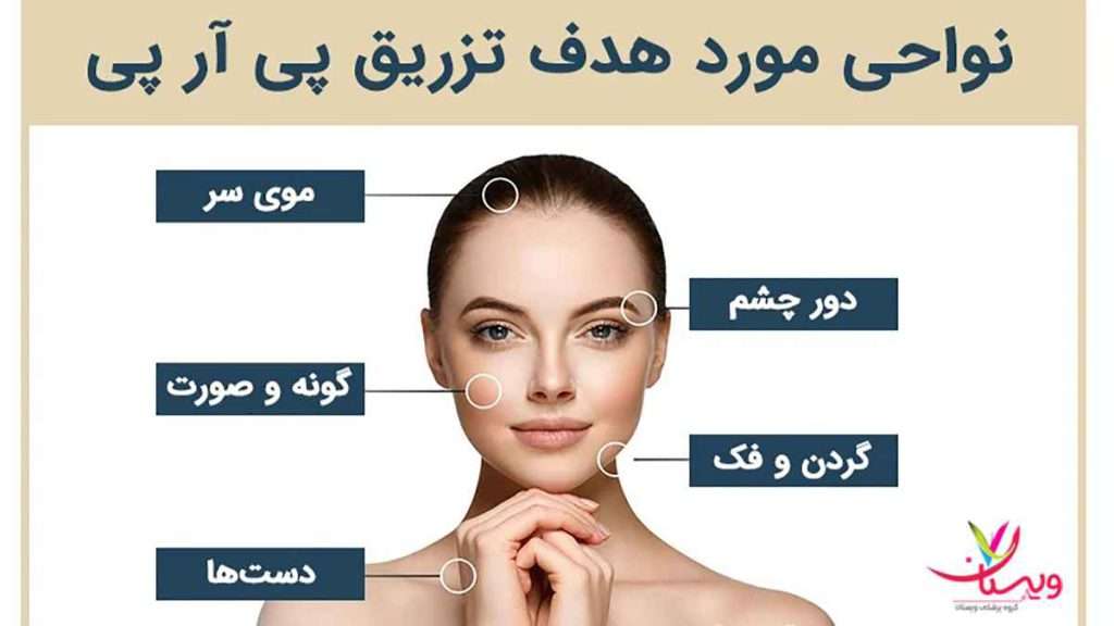 کاربرد پی ار پی