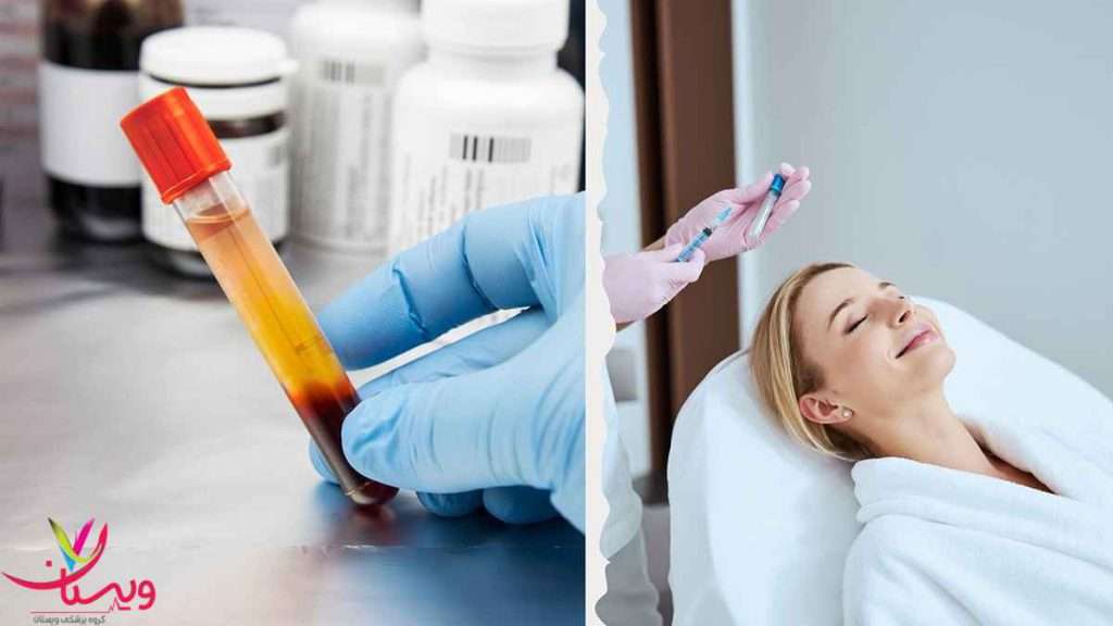 پی ار پی مو و صورت