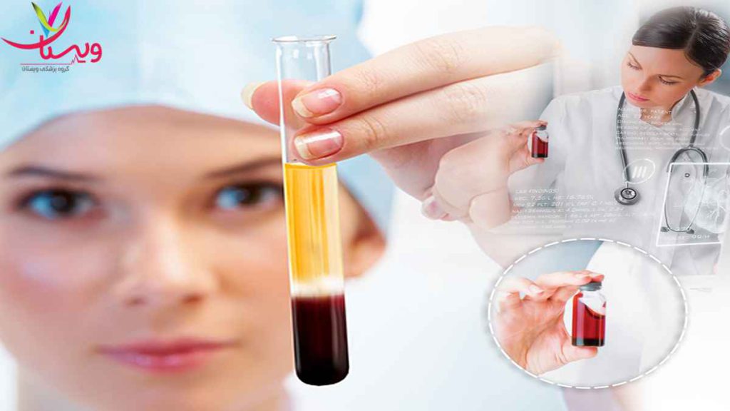 تزریق پی ار پی مو مراقبت از مو بعد از پی ار پی