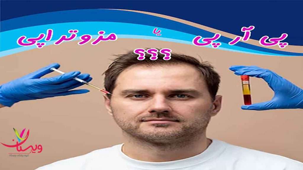 PRP and mesotherapy پی ار پی یا مزوتراپی