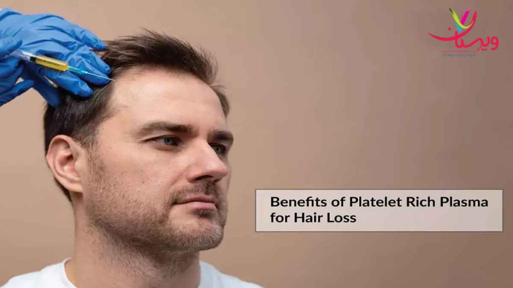 پی آر پی مو پی آر پی مو چیست