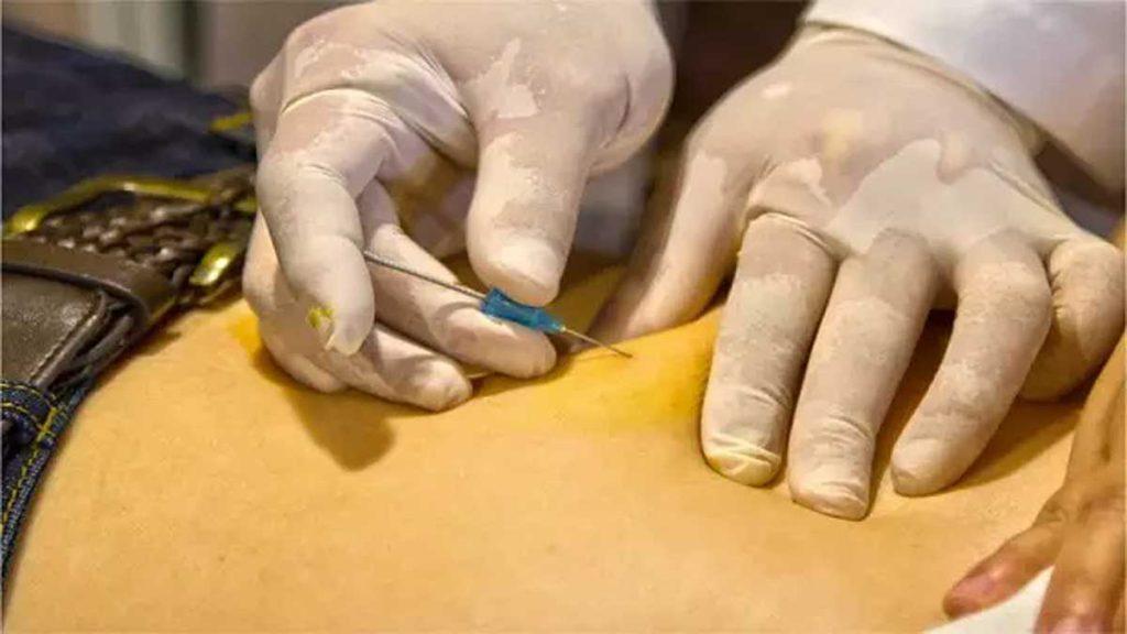 عوارض امبدینگ لاغری-عوارض امبدینگ شکم و پهلو (عوارض نخ انداختن شکم برای لاغری) فرو کردن سوزن به شکم یک بیمار توسط دکتر خوب برای امبدینگ که به عوارض امبدینگ لاغری و عوارض امبدینگ شکم و پهلو (عوارض نخ انداختن شکم برای لاغری) اشاره دارد