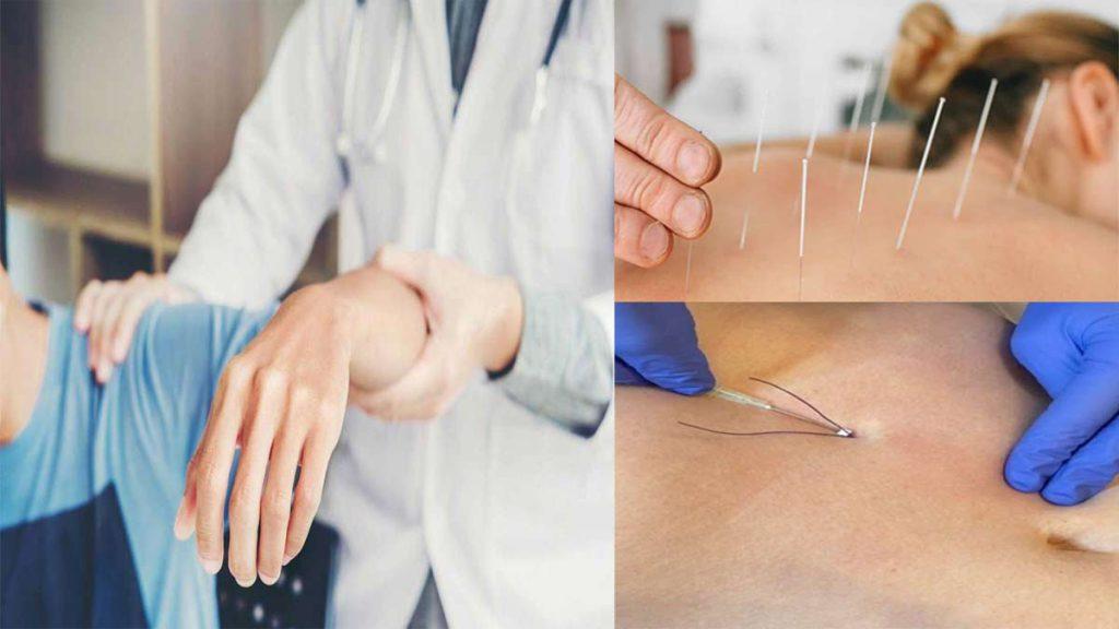 متخصص طب فیزیکی و توانبخشی در غرب تهران-بهترین متخصص طب فیزیکی و توانبخشی در ایران از چه روشهای درمانی استفاده میکند؟ توانبخشی دست یک بیمار توسط پزشک، طب سوزنی در پشت بیمار و امبدینگ لاغری شکم توسط پزشک که به متخصص طب فیزیکی و توانبخشی در غرب تهران و بهترین متخصص طب فیزیکی و توانبخشی در ایران از چه روشهای درمانی استفاده میکند؟ اشاره دارد