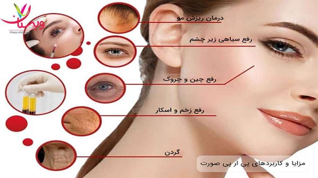 مزایای پی ار پی