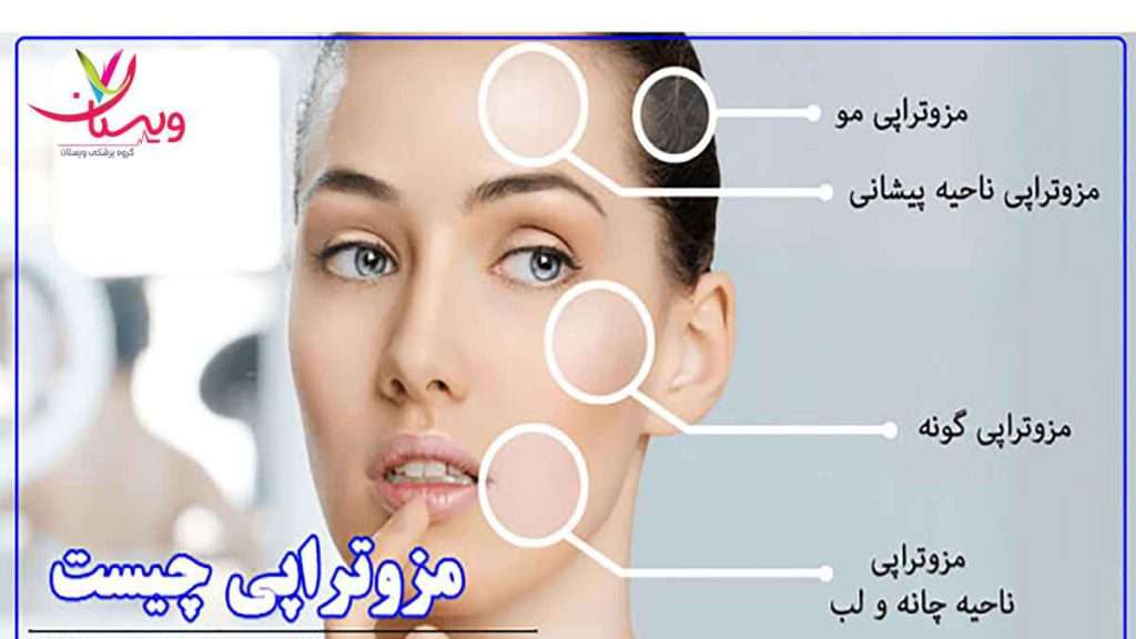 مزوتراپی چیست مزوتراپی و پی آر پی صورت