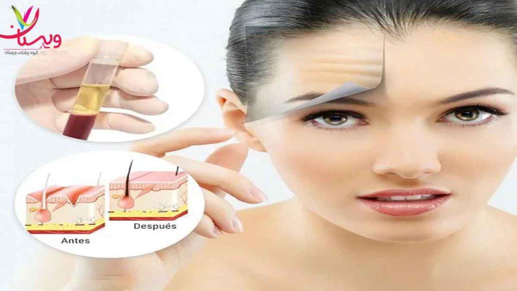 رفع چروک صورت با پی ار پی کاربرد پی ار پی