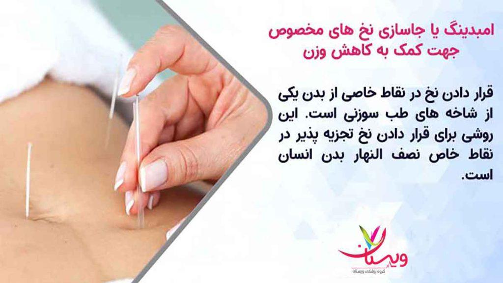 جاسازی نخ امبدینگ