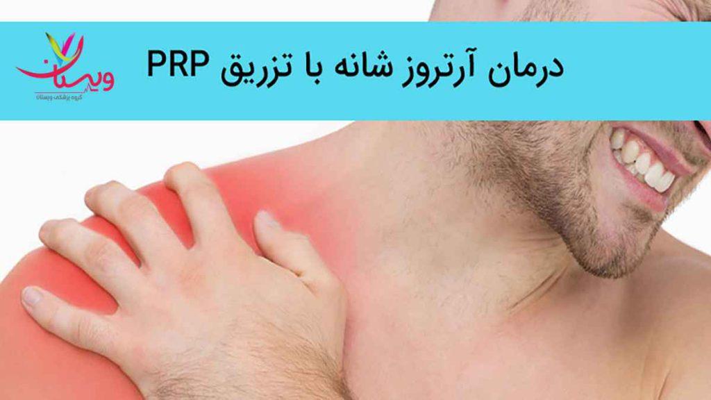 درمان آرتروز شانه نظرات مردم درباره پی ار پی