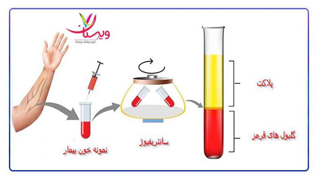 مراحل پی ار پی پی ار پی برای زیبایی
