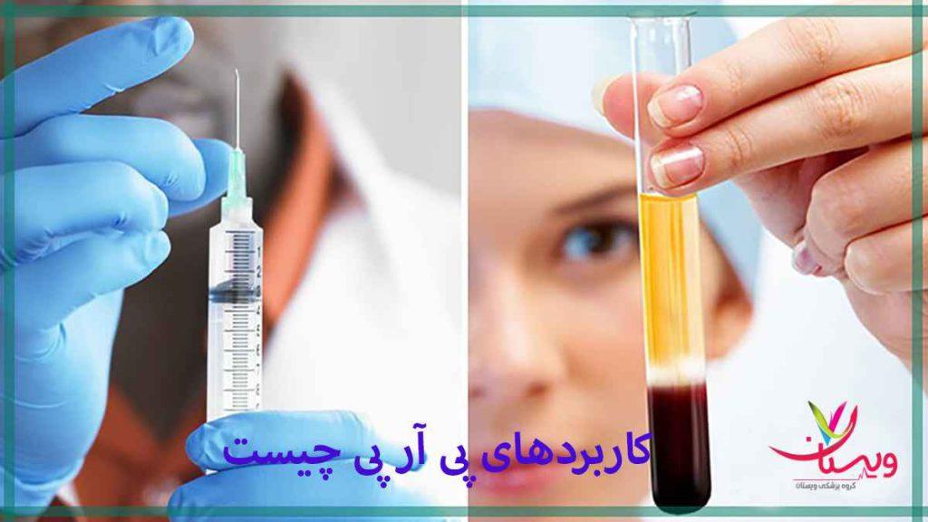پی آر پی شانه