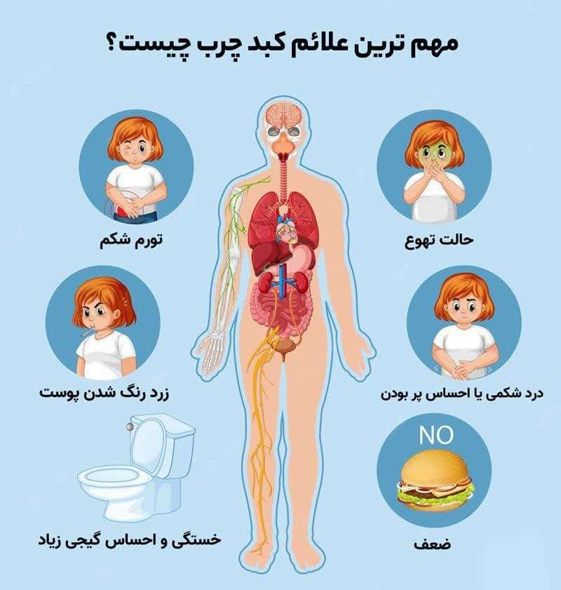 علائم کبد چرب