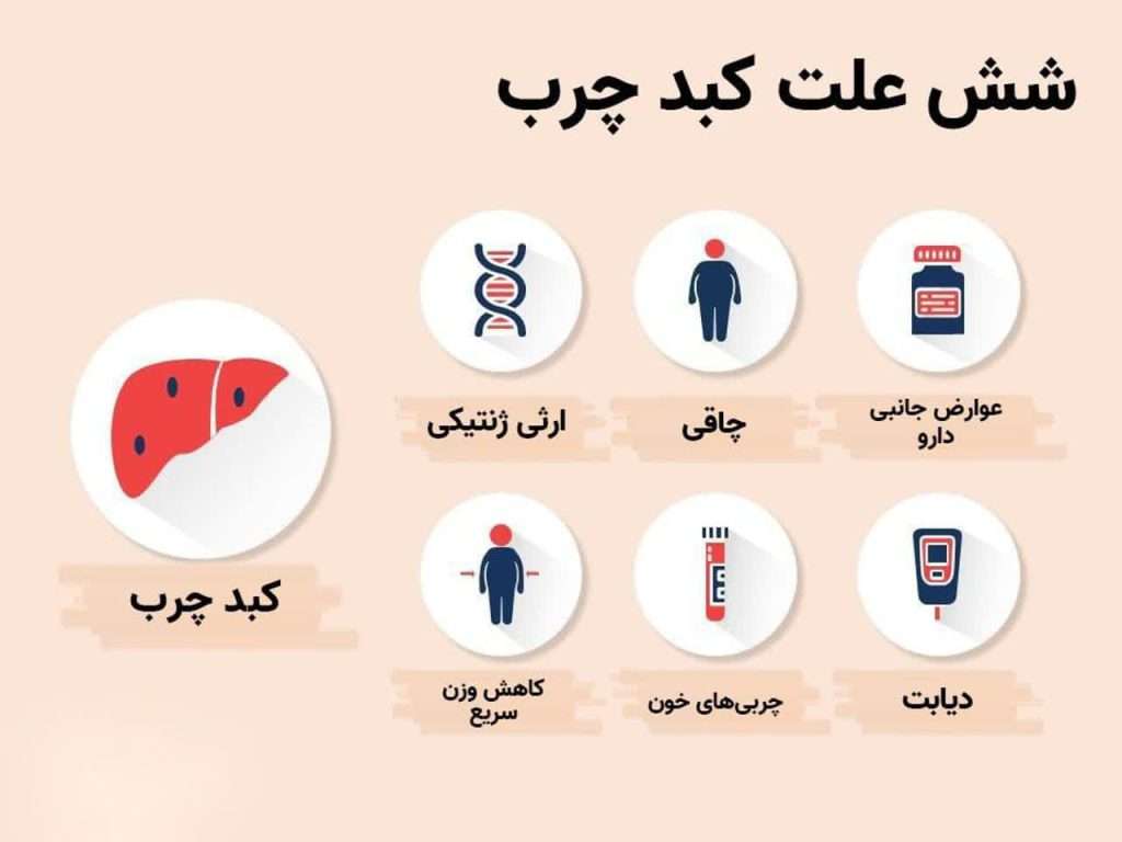 علت کبد چرب