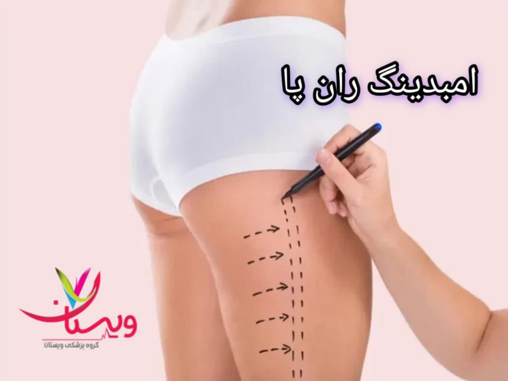 مزایا و معایب امبدینگ ران پا و لاغری موضعی ران پا با کاشت نخ
