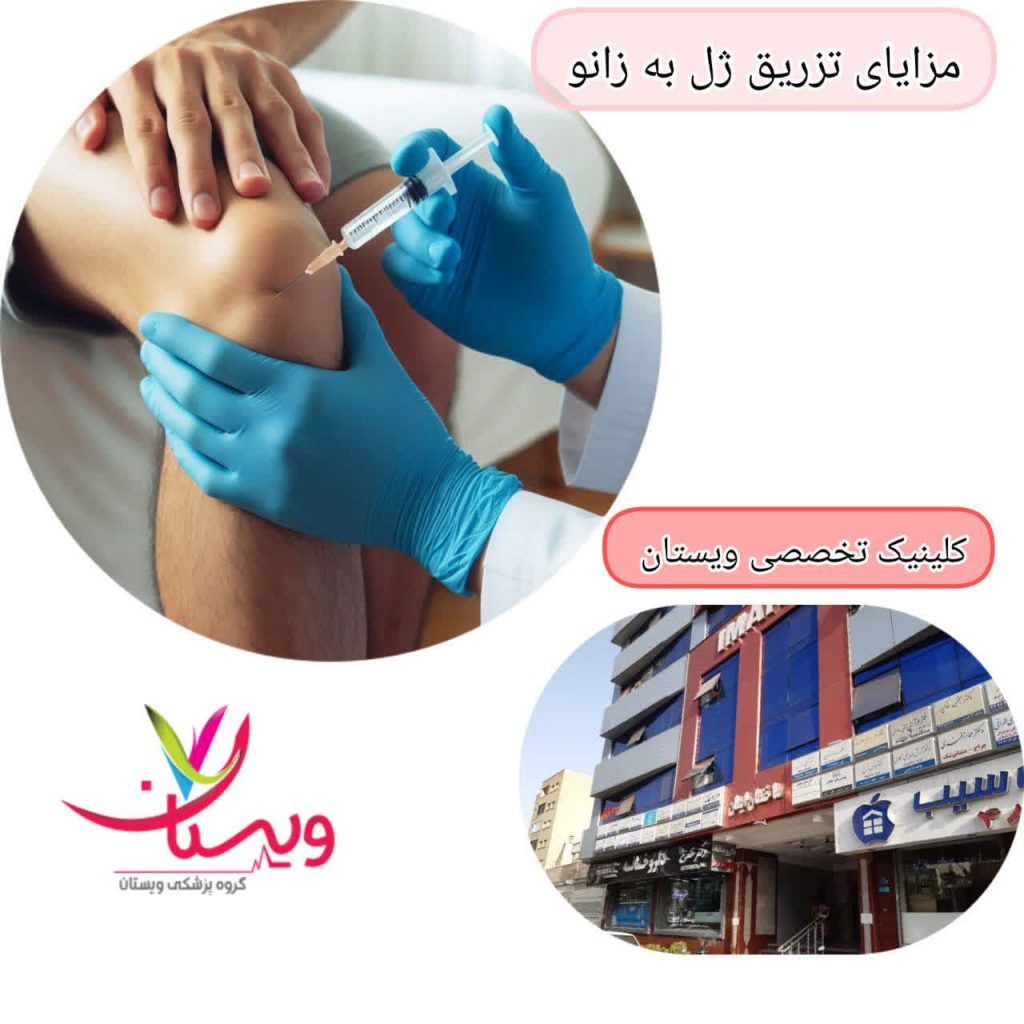 مزایای تزریق ژل به زانو مزایای تزریق ژل به زانو