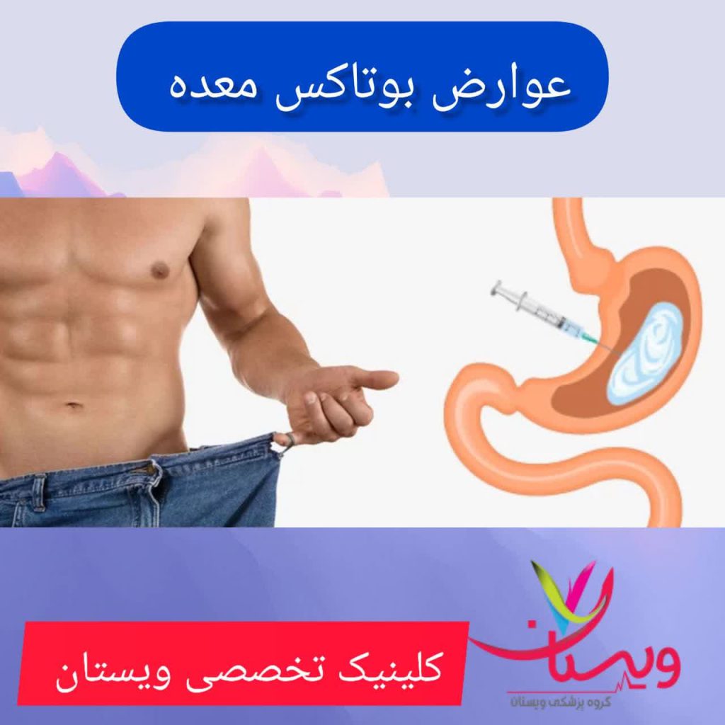 عوارض بوتاکس معده عوارض بوتاکس معده