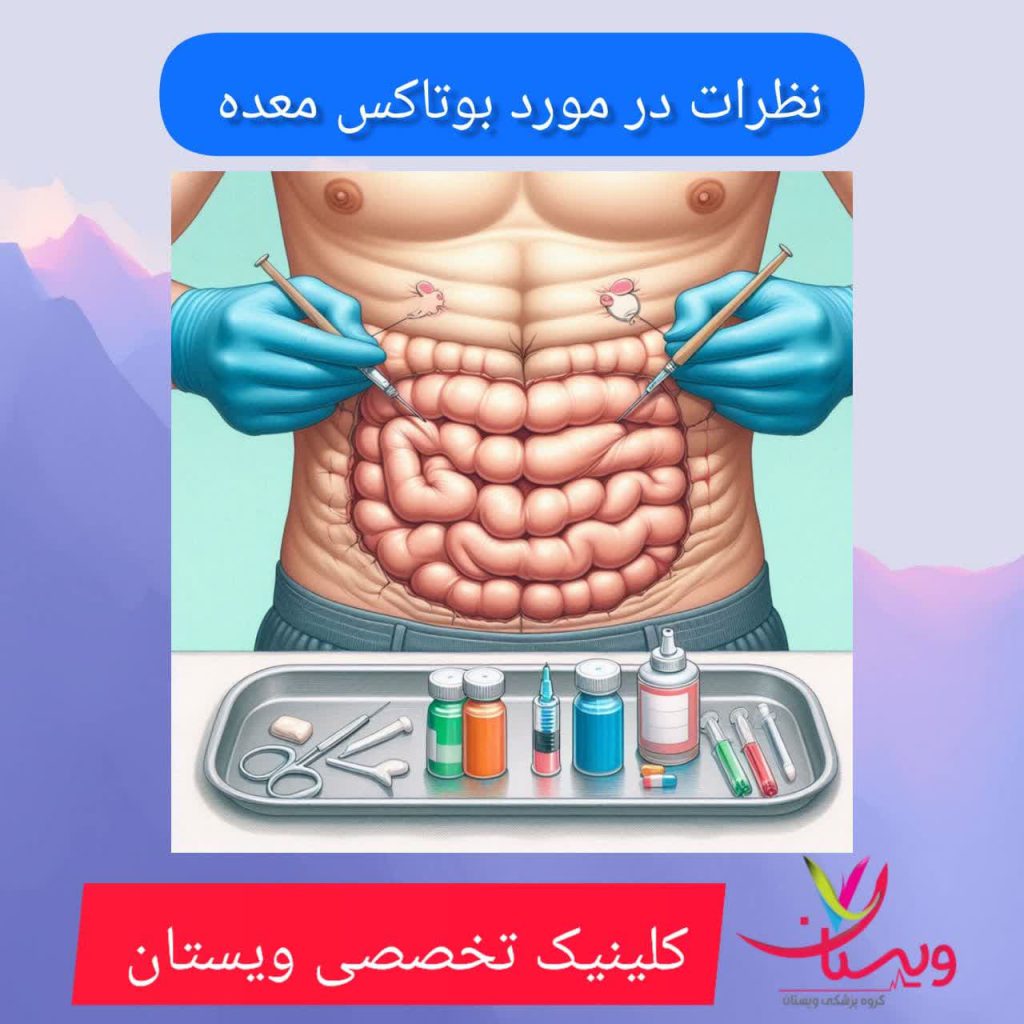 نظرات در مورد بوتاکس معده نظرات در مورد بوتاکس معده