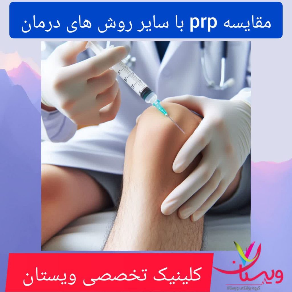 مقایسه PRP با سایر روش های درمان مقایسه PRP با سایر روش های درمان
