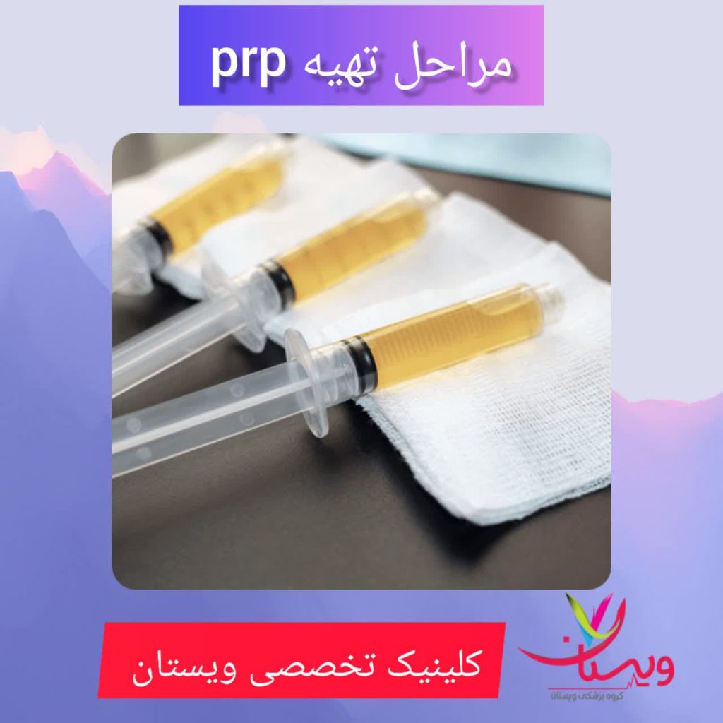 مراحل تهیه PRP مراحل تهیه PRP