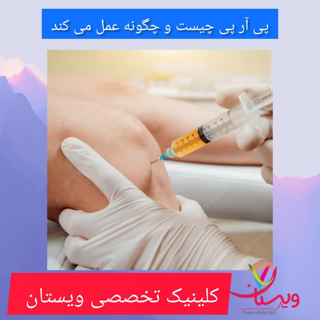 پی آر پی چیست؟چگونه عمل می کند پی آر پی چیست؟چگونه عمل می کند