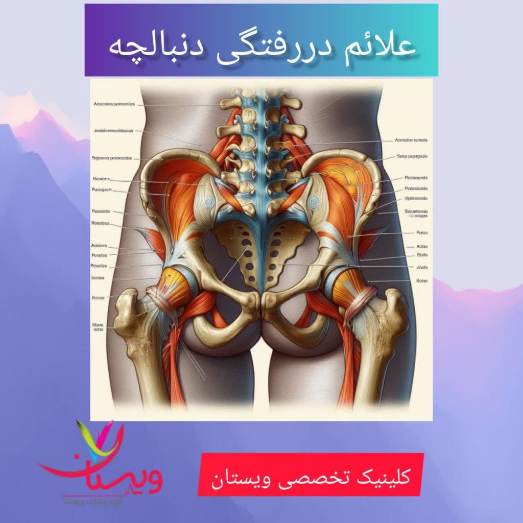 علائم دررفتگی دنبالچه علائم دررفتگی دنبالچه