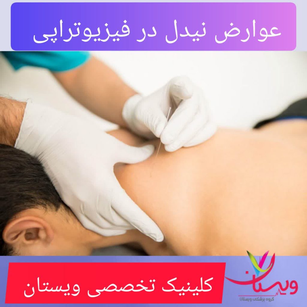 عوارض سوزن خشک عوارض سوزن خشک