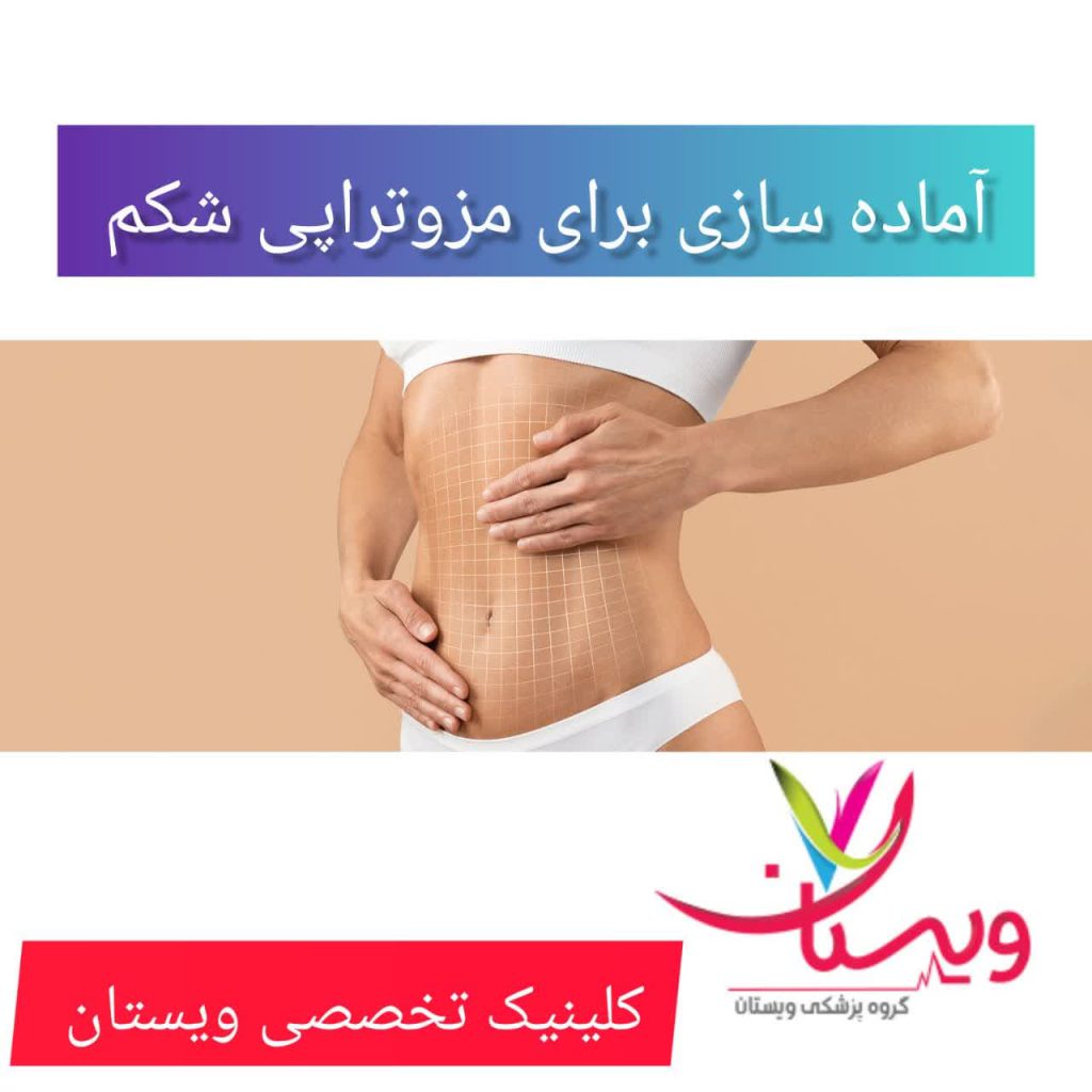 آماده سازی برای مزوتراپی شکم آماده سازی برای مزوتراپی شکم