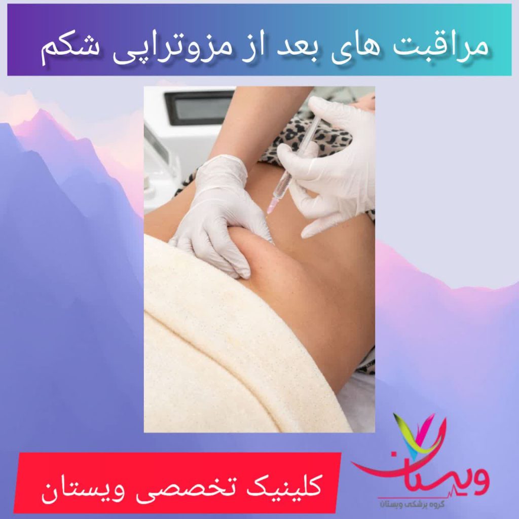 مراقبت های بعد از مزوتراپی شکم مراقبت های بعد از مزوتراپی شکم