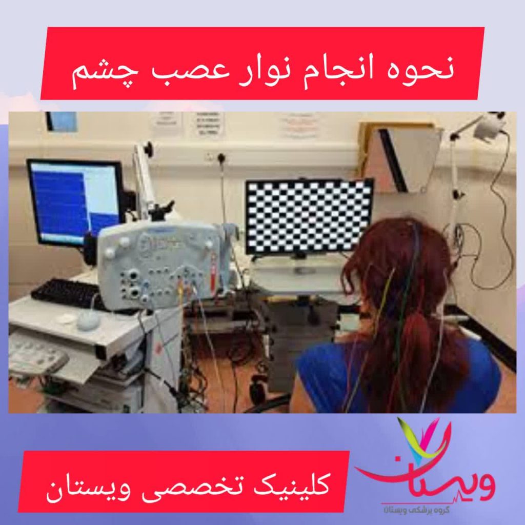 نحوه انجام نوار عصب چشم: نحوه انجام نوار عصب چشم: