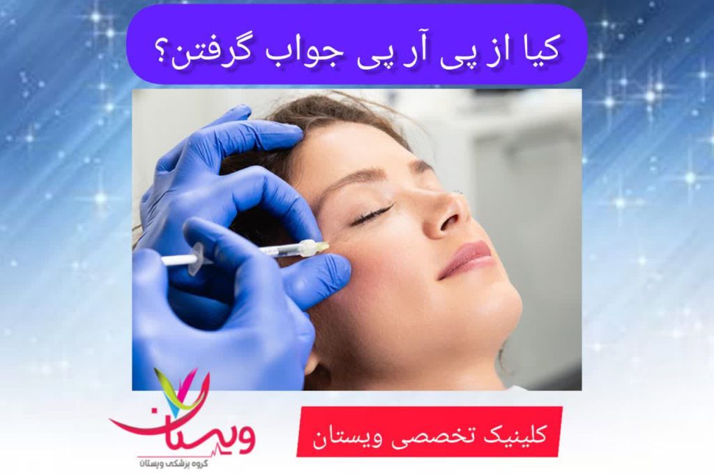 کیا از پی آر پی جواب گرفتن کیا از پی آر پی جواب گرفتن